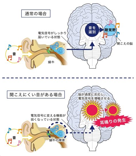 左耳鳴